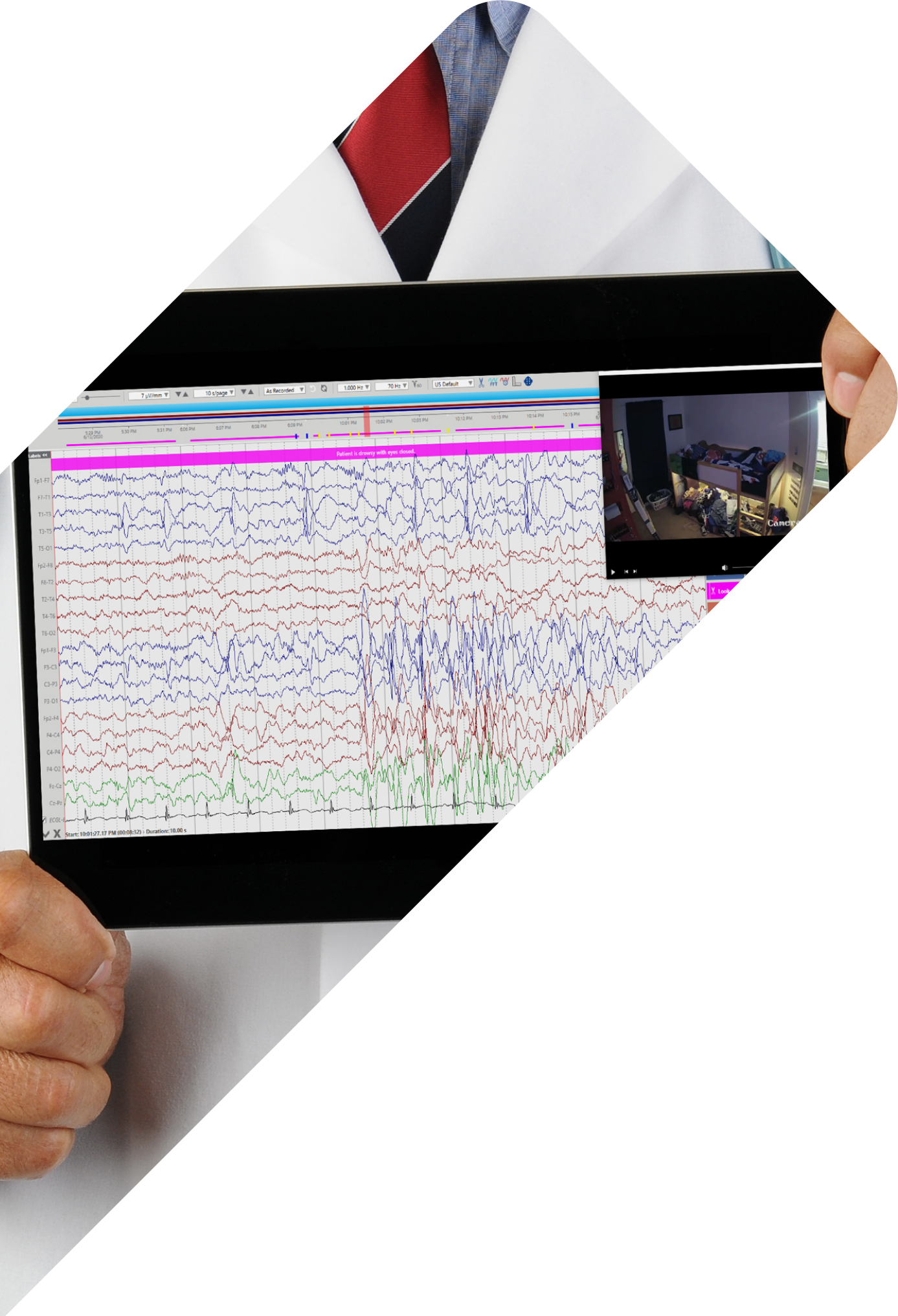 Video EEG at home near me – VEEG at home near me – Stratus – EEG test at home