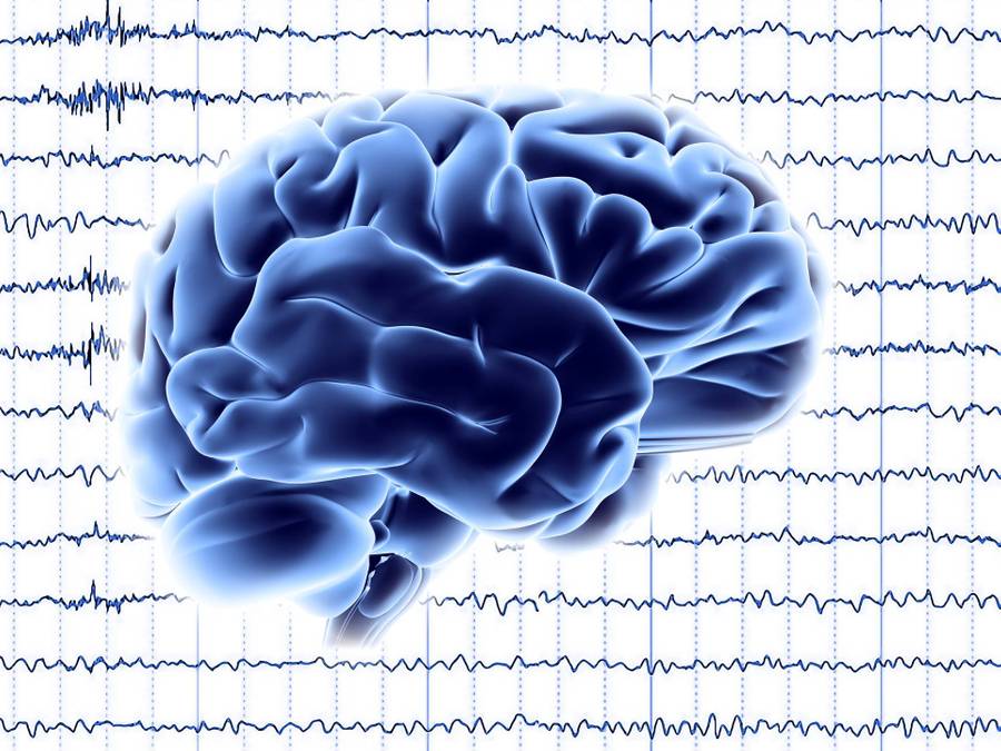Brain floating above EEG waveforms